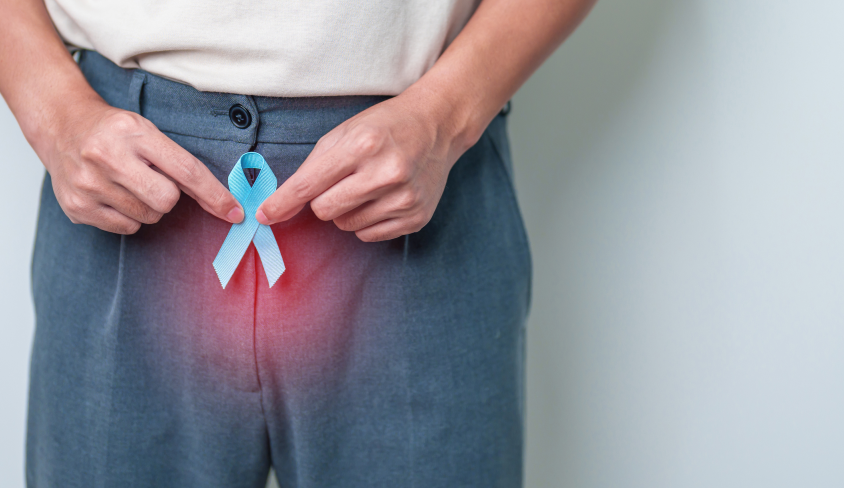 Open Radical Prostatectomy