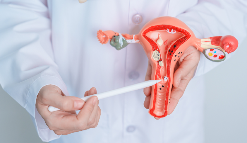 Robotic Vesicovaginal Fistula
										(VVF) Repair