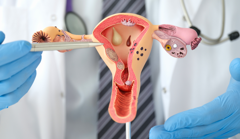 Ureteral Reimplantation